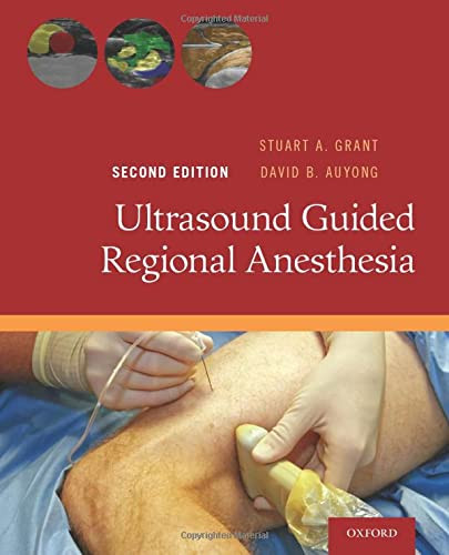 Ultrasound Guided Regional Anesthesia