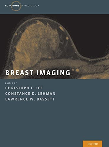 Breast Imaging (Rotations in Radiology)