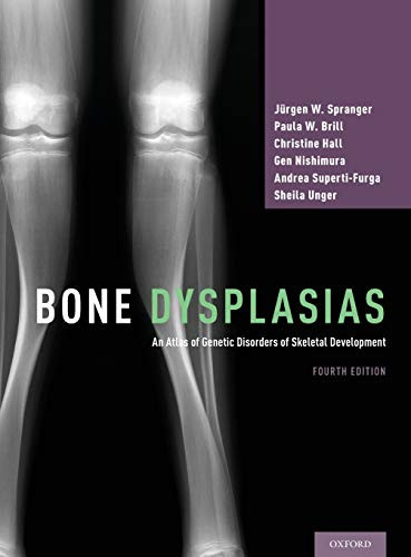Bone Dysplasias: An Atlas of Genetic Disorders of Skeletal