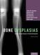 Bone Dysplasias: An Atlas of Genetic Disorders of Skeletal