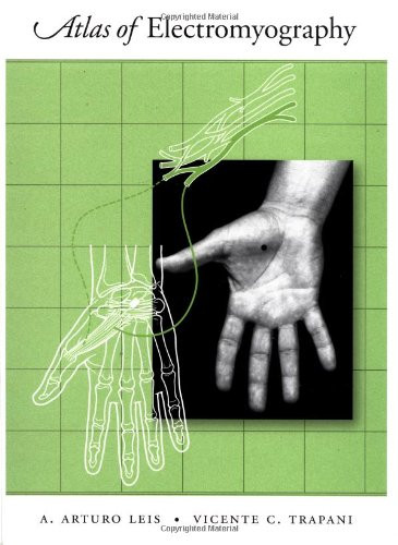 Atlas of Electromyography