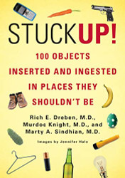 Stuck Up! 100 Objects Inserted and Ingested in Places They Shouldn - t