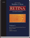 Retina (Ryan Retina)