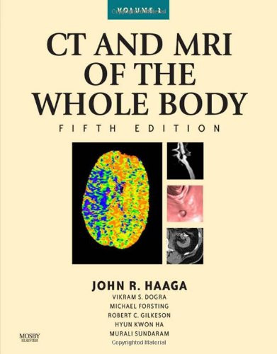 CT and MRI of the Whole Body
