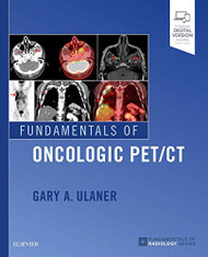 Fundamentals of Oncologic PET/CT (Fundamentals of Radiology)