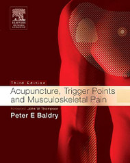 Acupuncture Trigger Points and Musculoskeletal Pain - Acupuncture