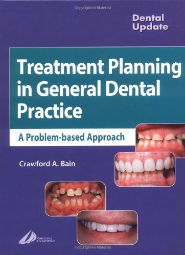 Treatment Planning in General Dental Practice (Dental Update)