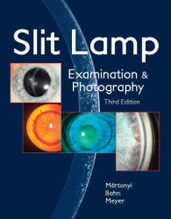 Slit Lamp: Examination and Photography