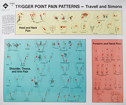 Trigger Points of Pain: Wall Charts (Set of 2)