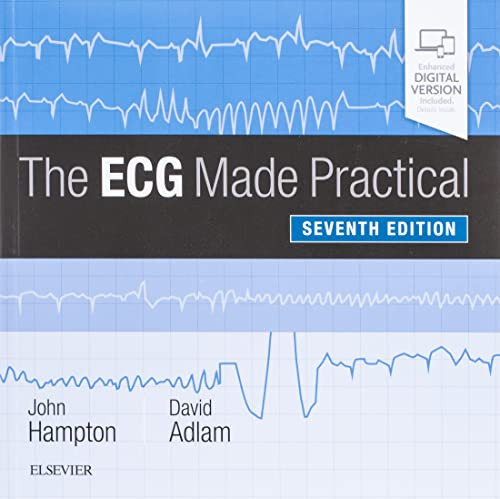 ECG Made Practical