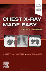 Chest X-Ray Made Easy