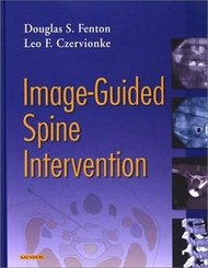 Image-Guided Spine Intervention