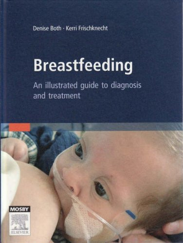 Breastfeeding: An Illustrated Guide To Diagnosis and Treatment