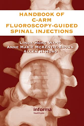 Handbook of C-Arm Fluoroscopy-Guided Spinal Injections