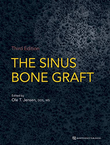 Sinus Bone Graft