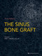 Sinus Bone Graft