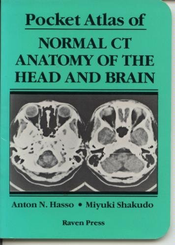 Pocket Atlas of Normal Ct Anatomy of the Head and Brain