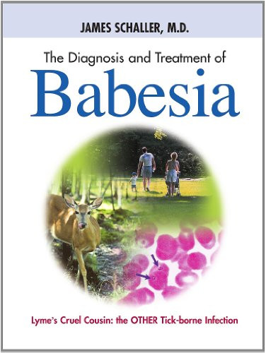 Diagnosis and Treatment of Babesia