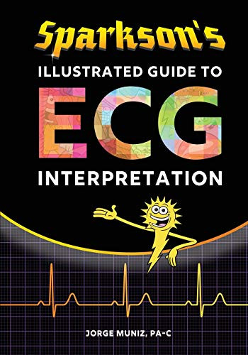 Sparkson's Illustrated Guide to ECG Interpretation
