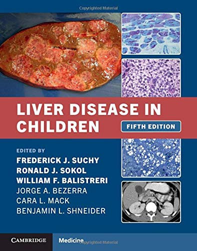 Liver Disease in Children