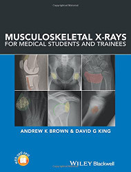 Musculoskeletal X-Rays for Medical Students and Trainees