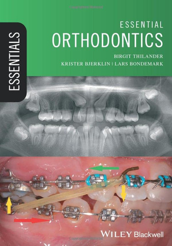 Essential Orthodontics (Essentials (Dentistry)