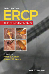 ERCP: The Fundamentals
