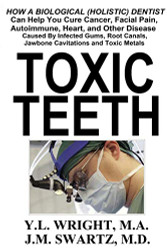 Toxic Teeth: How a Biological