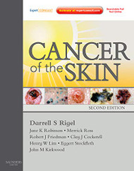 Cancer of the Skin: Expert Consult - Online and Print