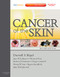 Cancer of the Skin: Expert Consult - Online and Print