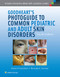 Goodheart's Photoguide to Common Pediatric and Adult Skin Disorders