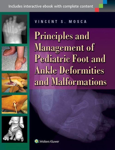 Principles and Management of Pediatric Foot and Ankle Deformities