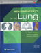 High-Resolution CT of the Lung