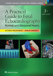 Practical Guide to Fetal Echocardiography