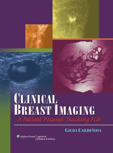 Clinical Breast Imaging
