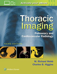 Thoracic Imaging: Pulmonary and Cardiovascular Radiology