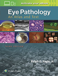 Eye Pathology: An Atlas and Text