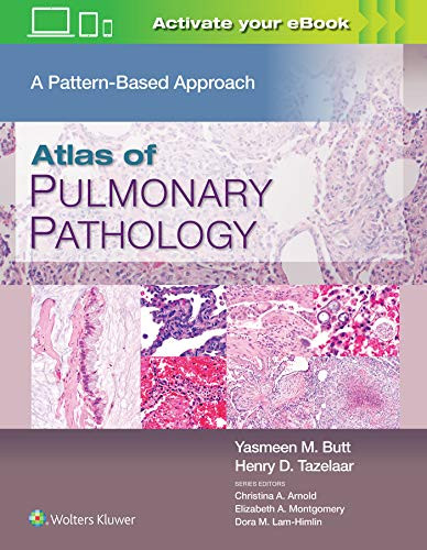 Atlas of Pulmonary Pathology: A Pattern Based Approach