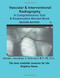 Vascular & Interventional Radiography A Comprehensive Text