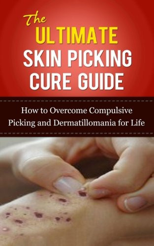 Ultimate Skin Picking Cure Guide