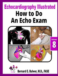 How to Do an Echo Exam (Echocardiography Illustrated)