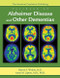 American Psychiatric Publishing Textbook of Alzheimer's Disease