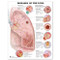 ACC Diseases of The Lung Anatomical Chart