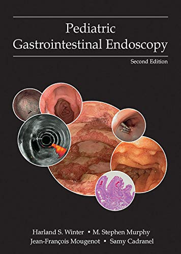 Pediatric Gastrointestinal Endoscopy
