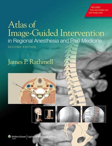 Atlas of Image-Guided Intervention in Regional Anesthesia and Pain