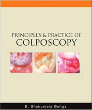 Principles And Practice Of Colposcopy