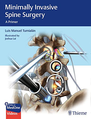 Minimally Invasive Spine Surgery: A Primer