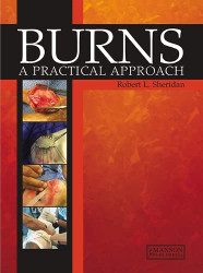Burns: A Practical Approach to Immediate Treatment and Long Term Care