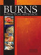 Burns: A Practical Approach to Immediate Treatment and Long Term Care