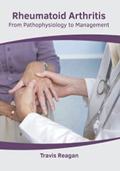 Rheumatoid Arthritis: From Pathophysiology to Management